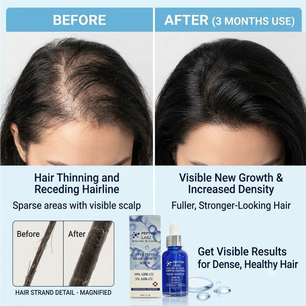 Essence de croissance des chev - Hair Care Tonic avis et prix