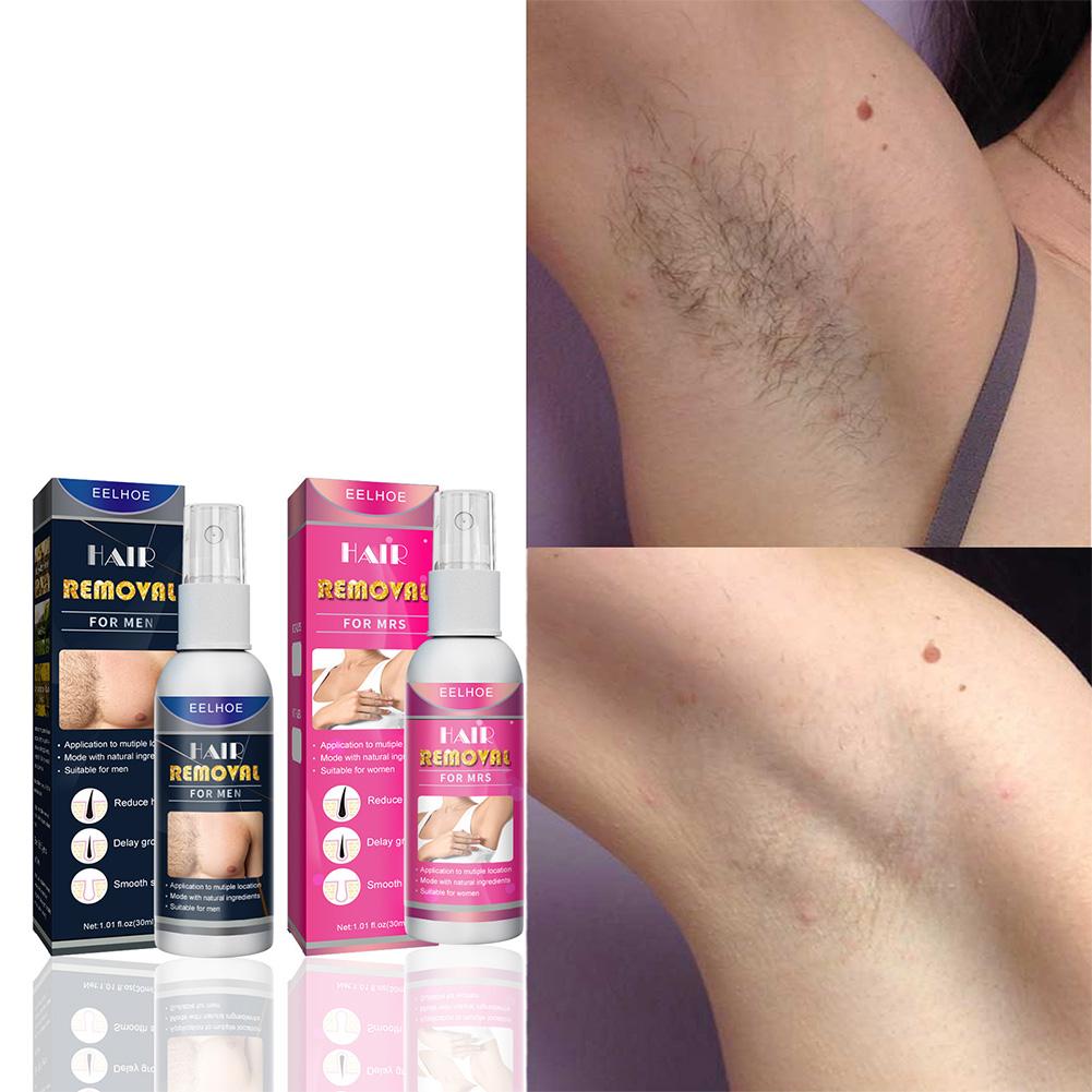 Épilateur Permanent indolore S - Hair Care China avis et prix